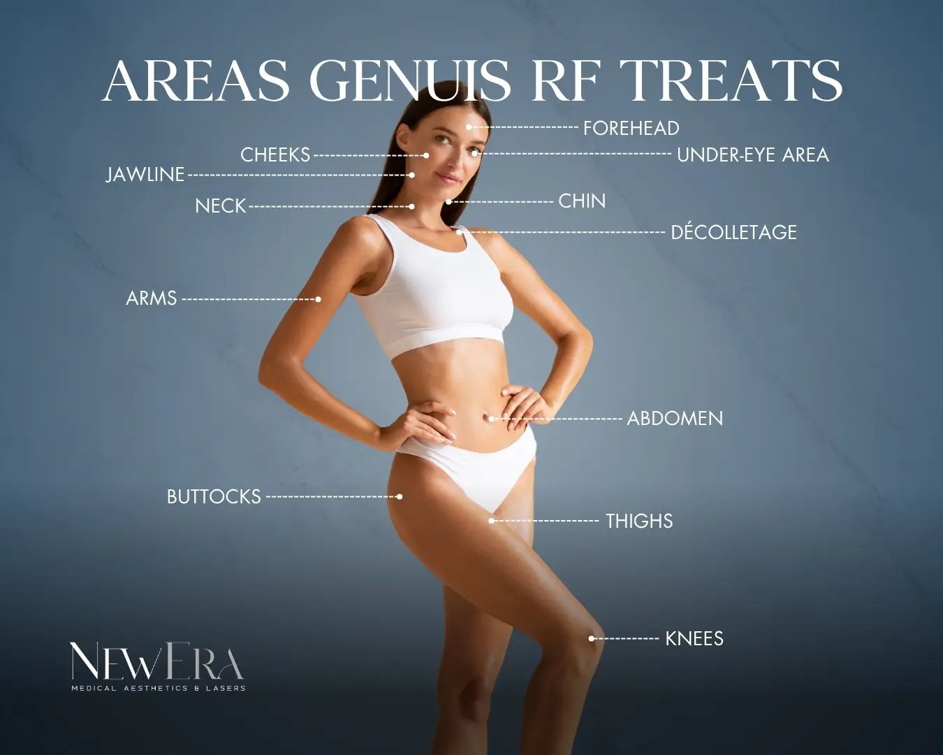 Diagram of facial areas Genius RF treats at NewEra Medical Aesthetics in Vienna, VA
