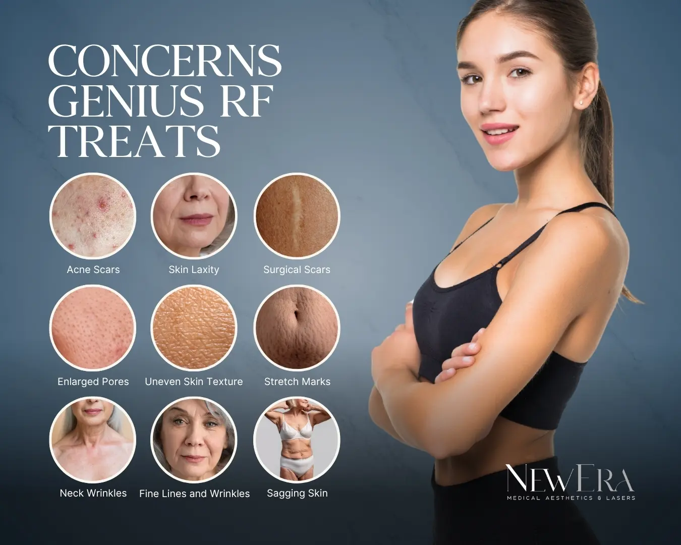 Diagram of concerns Genius RF microneedling treats at NewEra Medical Aesthetics, Vienna