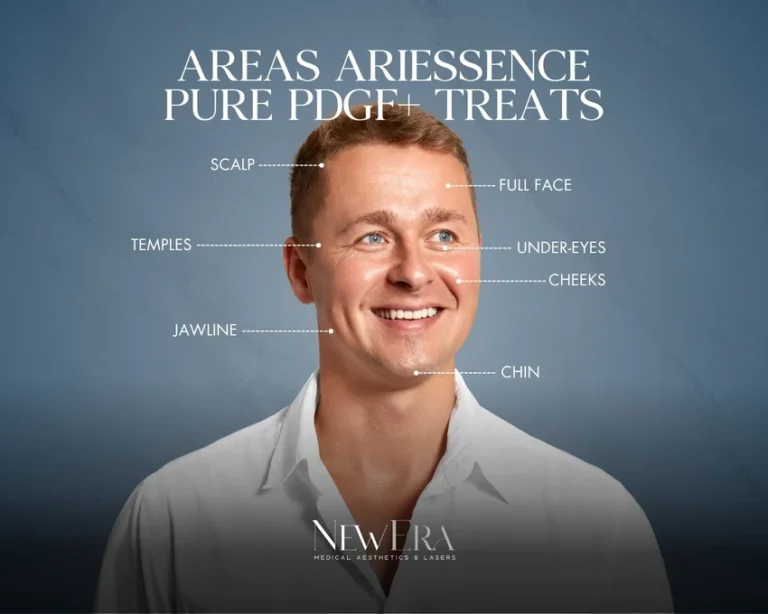 Diagram showing areas treated by Ariessence Pure PDGF+ including under-eyes, cheeks, temples, jawline, chin, full face, and scalp, highlighting skin rejuvenation, volume restoration, and hair regrowth benefits